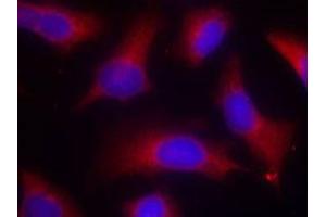 Immunofluorescent staining of methanol-fixed Hela cells using MAPT (phospho S262) polyclonal antibody  at 1:100-1:200 dilution. (MAPT 抗体  (pSer262))