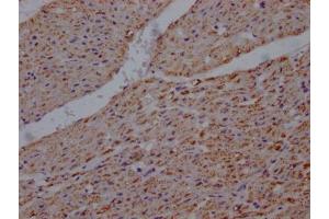 IHC image of ABIN7127865 diluted at 1:100 and staining in paraffin-embedded human heart tissue performed on a Leica BondTM system. (Recombinant UQCRC2 抗体)