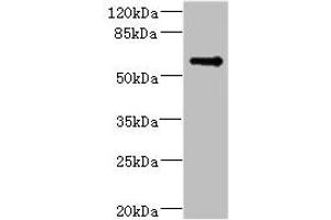 Western blot All lanes: TSNARE1 antibody IgG at 16 μg/mL + Mouse lung tissue Secondary Goat polyclonal to rabbit IgG at 1/10000 dilution Predicted band size: 56 kDa Observed band size: 56 kDa (TSNARE1 抗体  (AA 6-339))