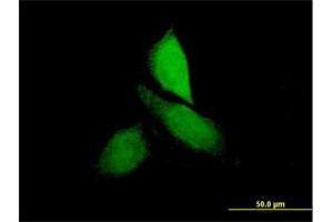 Immunofluorescence of purified MaxPab antibody to CNKSR3 on HeLa cell. (CNKSR3 抗体  (AA 1-555))