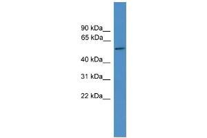 WB Suggested Anti-TTYH3 Antibody Titration:  0. (TTYH3 抗体  (Middle Region))