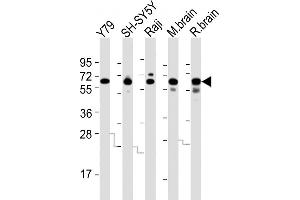 All lanes : Anti-DPYSL5 Antibody (C-term) at 1:2000 dilution Lane 1: Y79 whole cell lysates Lane 2: SH-SY5Y whole cell lysates Lane 3: Raji whole cell lysates Lane 4: mouse brain lysates Lane 5: rat brain lysates Lysates/proteins at 20 μg per lane. (DPYSL5 抗体  (C-Term))