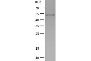 Western Blotting (WB) image for Argininosuccinate Lyase (ASL) (AA 1-464) protein (His tag) (ABIN7121890) (ASL Protein (AA 1-464) (His tag))