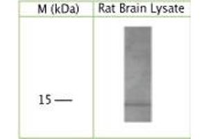 WB on rat brain lysate using Sheep antibody to human, rat, mouse GABA(A) receptor-associated protein (GABARAP, MM46, FLC3B): IgG at a concentration of 5 µg/ml under reducing condition. (GABARAP 抗体)