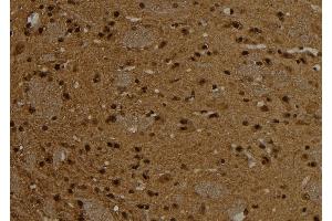 ABIN6261096 and ABIN6276787 at 1/100 staining Rat brain tissue by IHC-P.