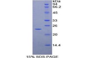 SDS-PAGE (SDS) image for Matrix Metallopeptidase 9 (Gelatinase B, 92kDa Gelatinase, 92kDa Type IV Collagenase) (MMP9) protein (ABIN1880145) (MMP 9 蛋白)
