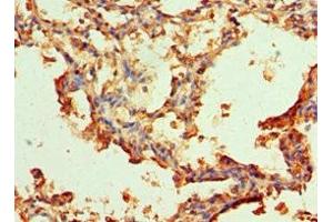 Immunohistochemistry (IHC) image for anti-serpin Peptidase Inhibitor, Clade A (Alpha-1 Antiproteinase, Antitrypsin), Member 3 (SERPINA3) (AA 24-423) antibody (ABIN7143754)