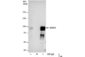 IP Image Immunoprecipitation of SOX13 protein from NT2D1 whole cell extracts using 5 μg of SOX13 antibody [N1C3], Western blot analysis was performed using SOX13 antibody [N1C3], EasyBlot anti-Rabbit IgG  was used as a secondary reagent. (SOX13 抗体)