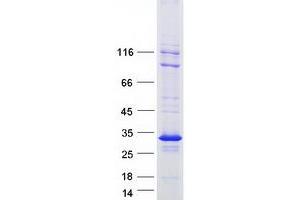 Western Blotting (WB) image for B-Cell Receptor-Associated Protein 29 (BCAP29) (Transcript Variant 2) protein (Myc-DYKDDDDK Tag) (ABIN2715171)
