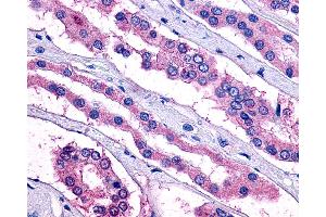 Immunohistochemistry (IHC) image for anti-Prostaglandin E Receptor 2 (Subtype EP2), 53kDa (PTGER2) (Extracellular Domain) antibody (ABIN1048569)