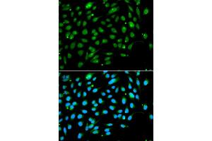 Immunofluorescence analysis of A549 cells using ING3 antibody. (ING3 抗体)