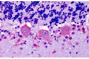 Immunohistochemistry (IHC) image for anti-Olfactory Receptor, Family 6, Subfamily N, Member 1 (OR6N1) (Extracellular Domain) antibody (ABIN1049188)