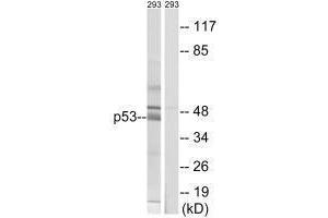 Western blot analysis of extracts from 293 cells, using p53 (Ab-378) antibody. (p53 抗体  (Ser378))