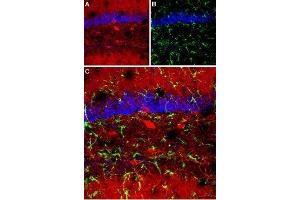 Expression of GABRA1 in mouse hippocampus - Immunohistochemical staining of mouse hippocampus using Anti-GABA(A) α1 Receptor (extracellular) Antibody (ABIN7043183, ABIN7044295 and ABIN7044296).