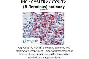 Image no. 2 for anti-Cysteinyl Leukotriene Receptor 2 (CYSLTR2) (N-Term) antibody (ABIN1733466)