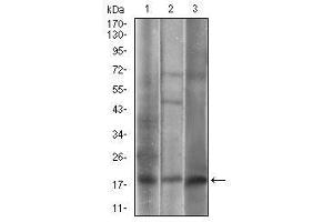 Western blot analysis using CAV2 mouse mAb against A549 (1), 3T3-L1 (2), A431 (3) cell lysate. (Caveolin 2 抗体  (AA 1-86))