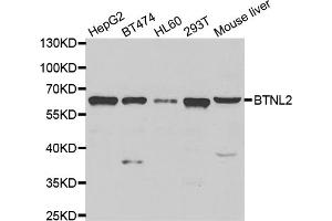 Western blot analysis of extracts of various cell lines, using BTNL2 antibody (ABIN5975278) at 1/1000 dilution.