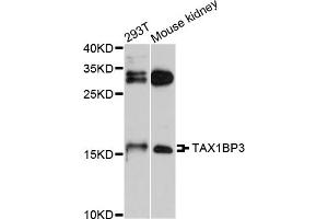 Western blot analysis of extracts of various cell lines, using TAX1BP3 antibody. (TAX1BP3 抗体)
