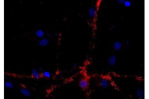 Indirect immunostaining of PFA fixed rat hippocampus neurons (dilution 1 : 500; red). (DNAJC5 抗体)