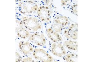 Immunohistochemistry of paraffin-embedded human stomach using THOC1 antibody at dilution of 1:100 (x40 lens). (THOC1 抗体)