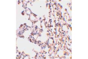 Immunohistochemical staining of mouse lung tissue using BID polyclonal antibody  at 2 ug/mL . (BID 抗体  (C-Term))