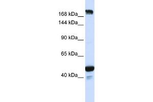 WB Suggested Anti-KIAA1618 Antibody Titration:  0. (RNF213 抗体  (N-Term))