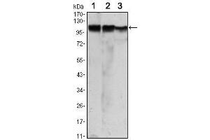 Western Blot showing HK2 antibody used against Jurkat (1), Hela (2) and HEK293 (3) cell lysate. (Hexokinase 2 抗体)