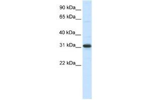 WB Suggested Anti-NRIP2 Antibody Titration:  0. (NRIP2 抗体  (N-Term))