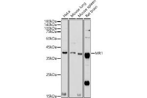 Western blot analysis of extracts of various cell lines, using MR1 antibody (ABIN6131925, ABIN6143983, ABIN6143984 and ABIN6224070) at 1:1000 dilution. (MR1 抗体  (AA 20-260))