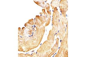 Immunohistochemical analysis of paraffin-embedded H. (SMAD1 抗体  (AA 163-196))
