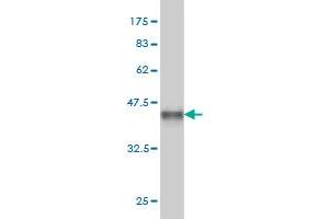 Western Blot detection against Immunogen (35. (CDK8 抗体  (AA 375-464))