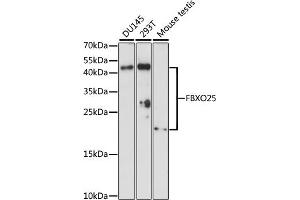 Western blot analysis of extracts of various cell lines, using FBXO25 antibody (ABIN7267087) at 1:1000 dilution. (FBXO25 抗体  (AA 142-291))