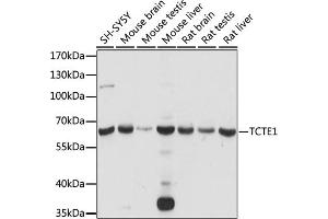 Western blot analysis of extracts of various cell lines, using TCTE1 antibody (ABIN7270710) at 1:1000 dilution. (TCTE1 抗体  (AA 1-300))
