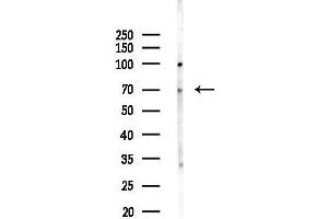 Western blot analysis of lysates from COLO205 cells, using AATF Antibody at 1/1000 dilution.
