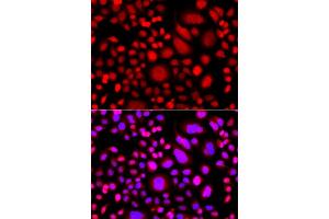 Immunofluorescence analysis of A549 cell using PRKAG3 antibody.