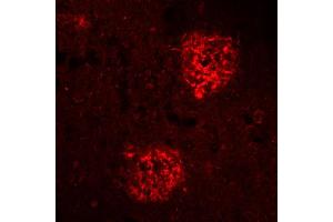 Immunohistochemistry (IHC) image for anti-Amyloid beta 1-40 (Abeta 1-40) (AA 33-40) antibody (ABIN1742442) (Abeta 1-40 抗体  (AA 33-40))