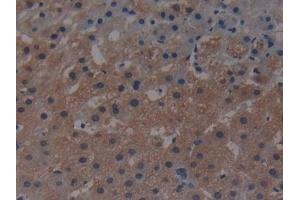 Detection of MAP3K1 in Human Liver Tissue using Polyclonal Antibody to Mitogen Activated Protein Kinase Kinase Kinase 1 (MAP3K1) (MAP3K1 抗体  (AA 1307-1509))