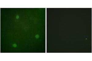 Immunofluorescence analysis of NIH-3T3 cells, using Artemis (Ab-516) Antibody. (DCLRE1C 抗体  (AA 482-531))
