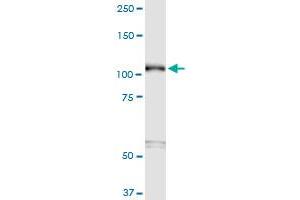 Western Blotting (WB) image for anti-Sema Domain, Transmembrane Domain (TM), and Cytoplasmic Domain, (Semaphorin) 6B (SEMA6B) (AA 28-126) antibody (ABIN948948)