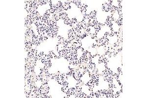 Immunohistochemistry (Paraffin-embedded Sections) (IHC (p)) image for anti-General Transcription Factor IIF, Polypeptide 2, 30kDa (GTF2F2) antibody (ABIN7074036)