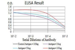 Black line: Control Antigen (100 ng),Purple line: Antigen (10 ng), Blue line: Antigen (50 ng), Red line:Antigen (100 ng) (KDM6A 抗体  (AA 1252-1401))