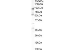 Image no. 1 for anti-Oxysterol Binding Protein-Like 10 (OSBPL10) (Internal Region) antibody (ABIN374621) (OSBPL10 抗体  (Internal Region))
