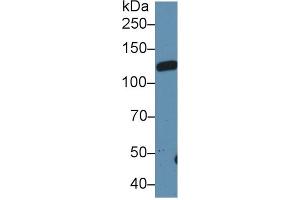 Western blot analysis of Rat Serum, using Rat LIFR Antibody (1 µg/ml) and HRP-conjugated Goat Anti-Rabbit antibody ( (LIFR 抗体  (AA 152-291))