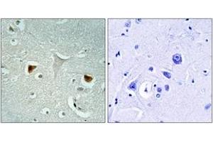 Immunohistochemistry analysis of paraffin-embedded human brain tissue, using STAT3 (Ab-727) Antibody. (STAT3 抗体  (AA 694-743))