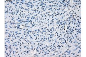 Immunohistochemical staining of paraffin-embedded colon tissue using anti-AURKCmouse monoclonal antibody.
