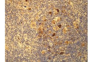 anti-Epstein-Barr Virus Latent Membrane Protein 1 (EBV LMP1) (AA 293-312), (Internal Region) antibody