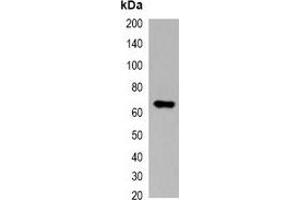 Western blot analysis of over-expressed Myc-tagged protein in 293T cell lysate. (Myc Tag 抗体)