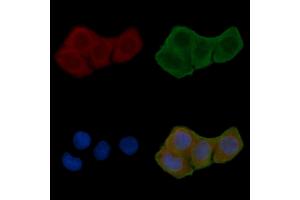 ABIN7094646 and ABIN7098697 staining Hela cells(24h of starvation treatment) by IF/ICC.