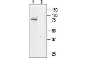 Western blot analysis of rat kidney lysate: - 1. (Chloride Channel 5 抗体  (Extracellular))