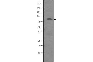 Western blot analysis of ITGB8 expression in Placenta lysate ,The lane on the left is treated with the antigen-specific peptide. (ITGB8 抗体  (Internal Region))